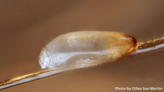 View of a louse egg on hair shaft Close-up view of a louse egg on hair shaft