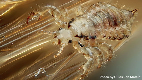 Microscopic view of a louse Microscopic view of a louse