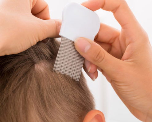 Close-up Of Female Doctor performing comb treatment On Boy's Hair With Comb
