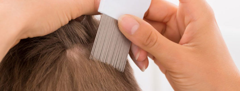 Close-up Of Female Doctor performing comb treatment On Boy's Hair With Comb